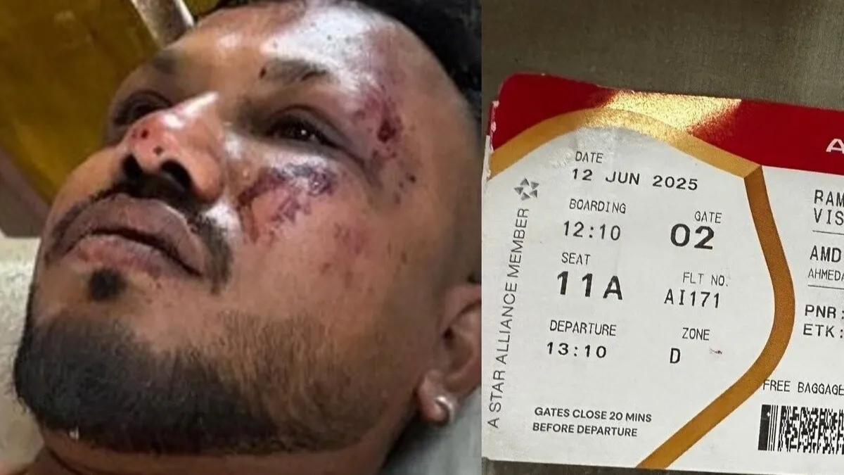 The Story of Vishwas Kumar the Only Surviving Passenger of Air India Flight AI-171